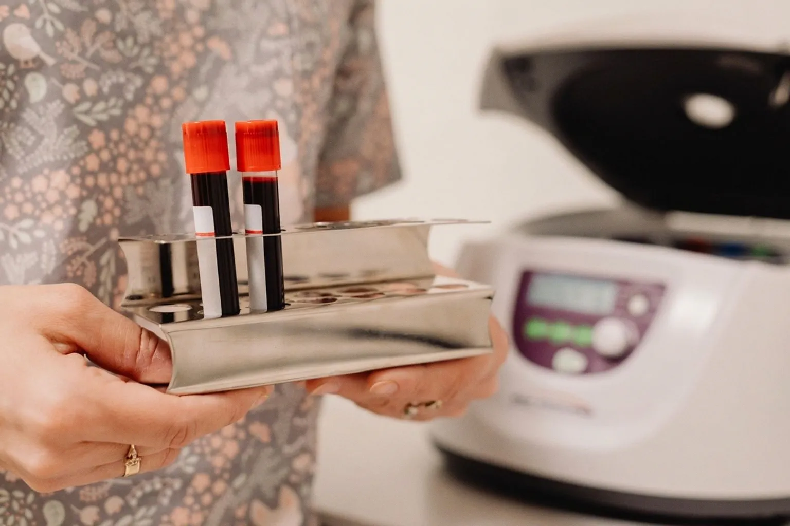Bridging the Gap: How Proteomics Solves Diagnostic Mysteries in Rare Pediatric Diseases