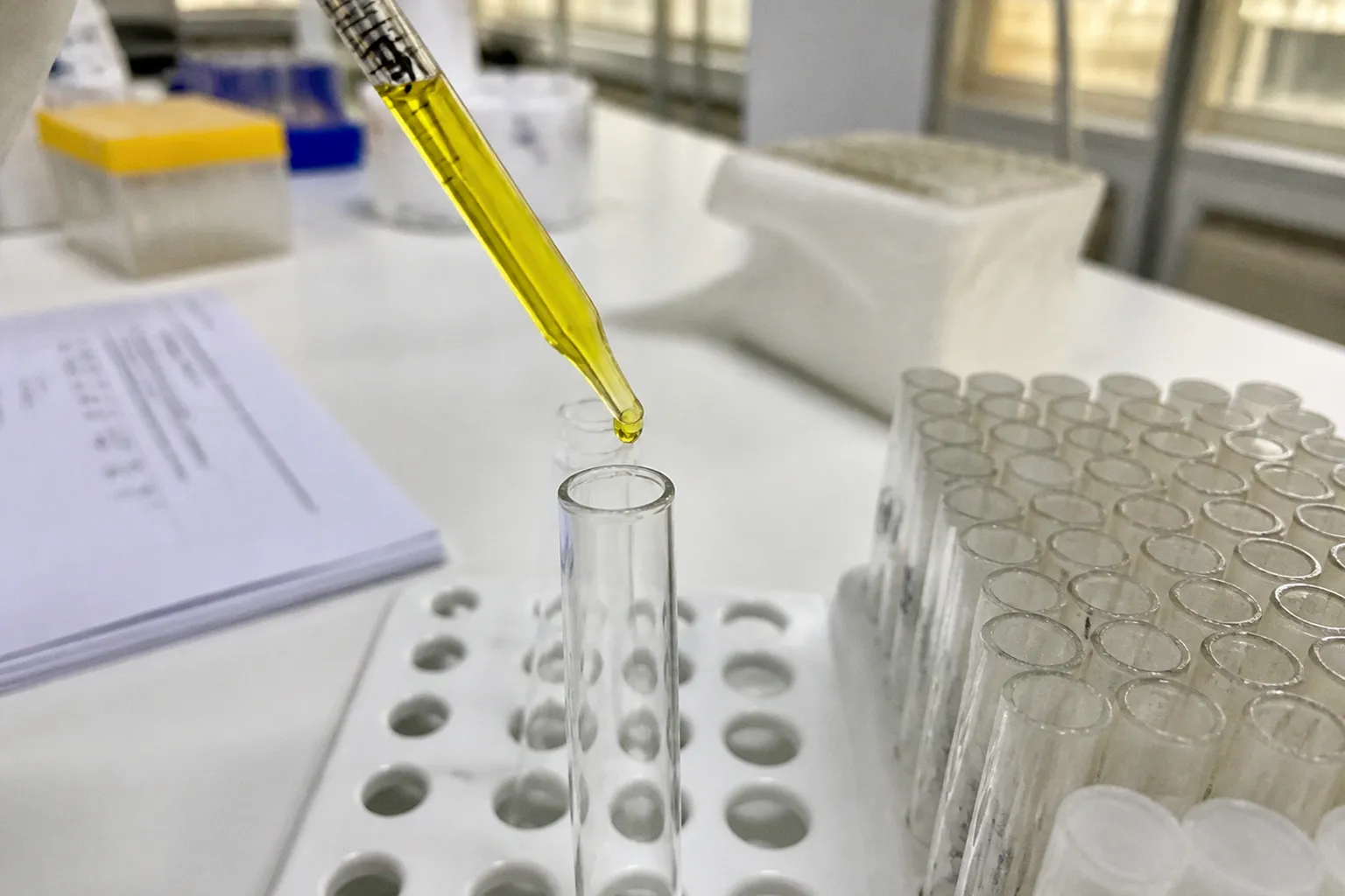 Dihydrorhodamine assay: the path to CGD diagnosis