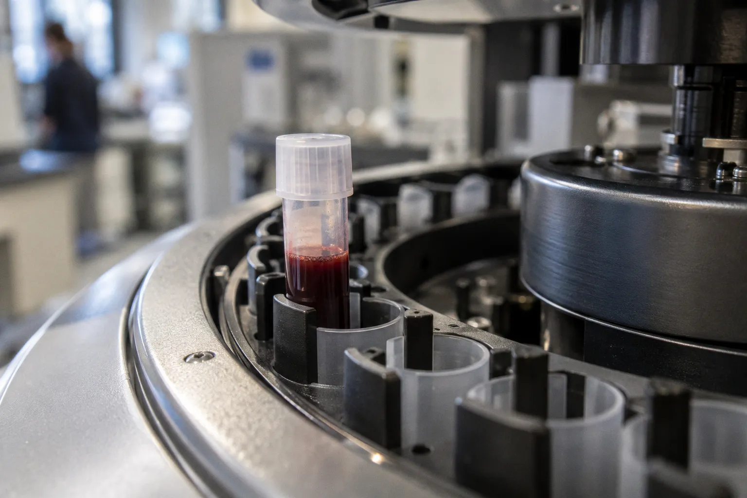 FDA Approval of Fayuvi for Sanfilippo Syndrome Type A: A Critical Clinical Review