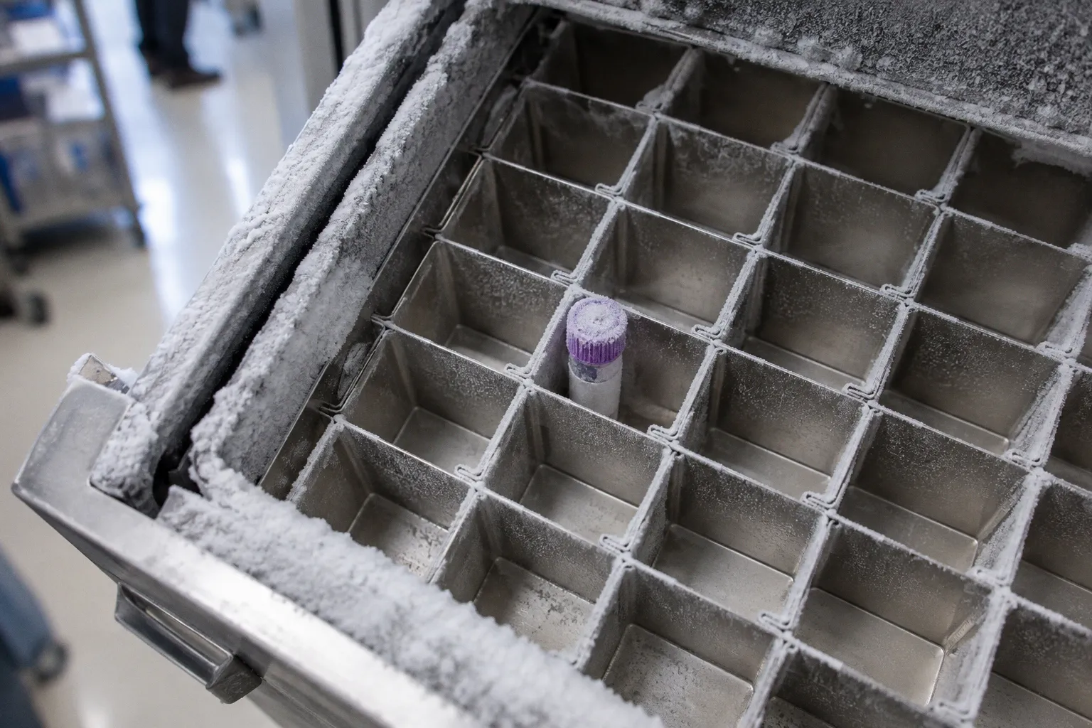 Flow cytometry results: navigating pediatric immune profiles