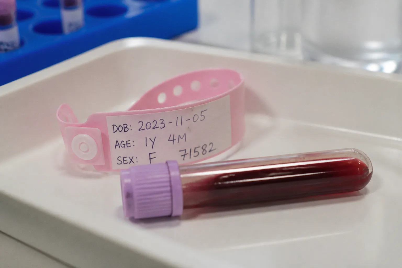 Pediatric flow cytometry: why age-specific ranges matter