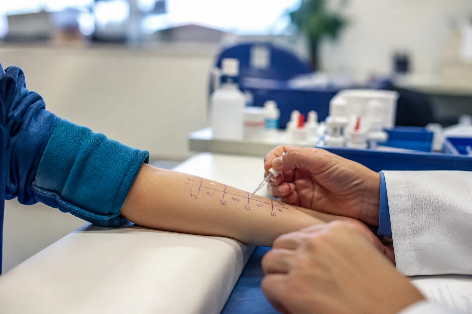Refining Pediatric Drug Allergy Testing: New EAACI Standards for Skin Sensitivity