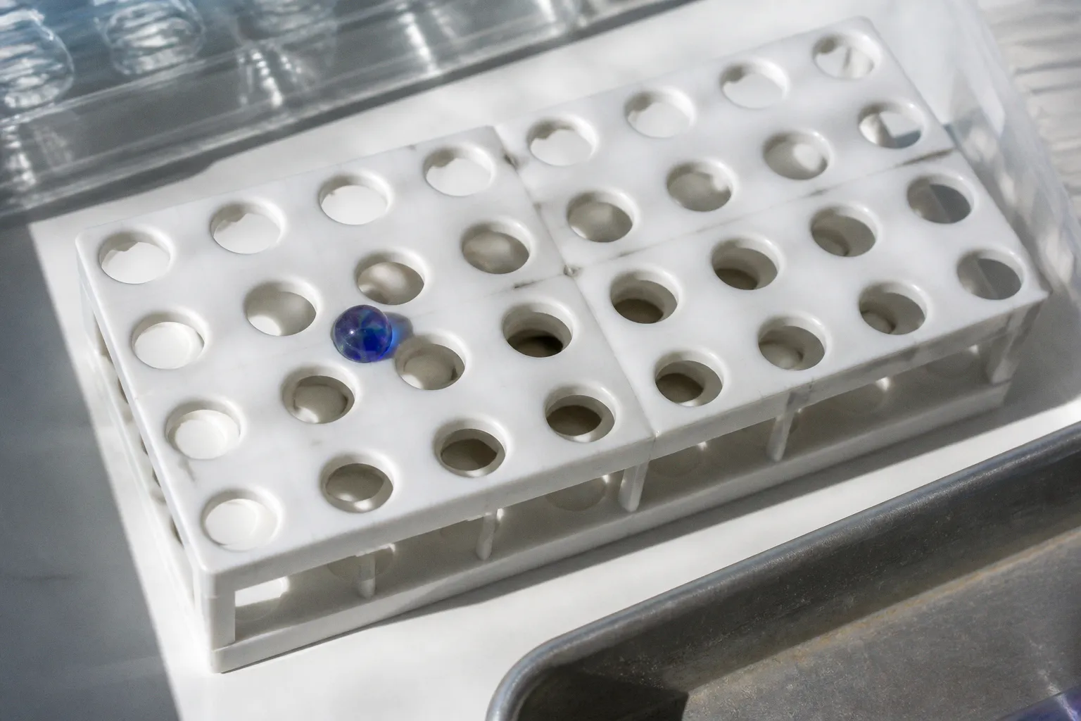 SCID screening false positives: avoiding diagnostic panic