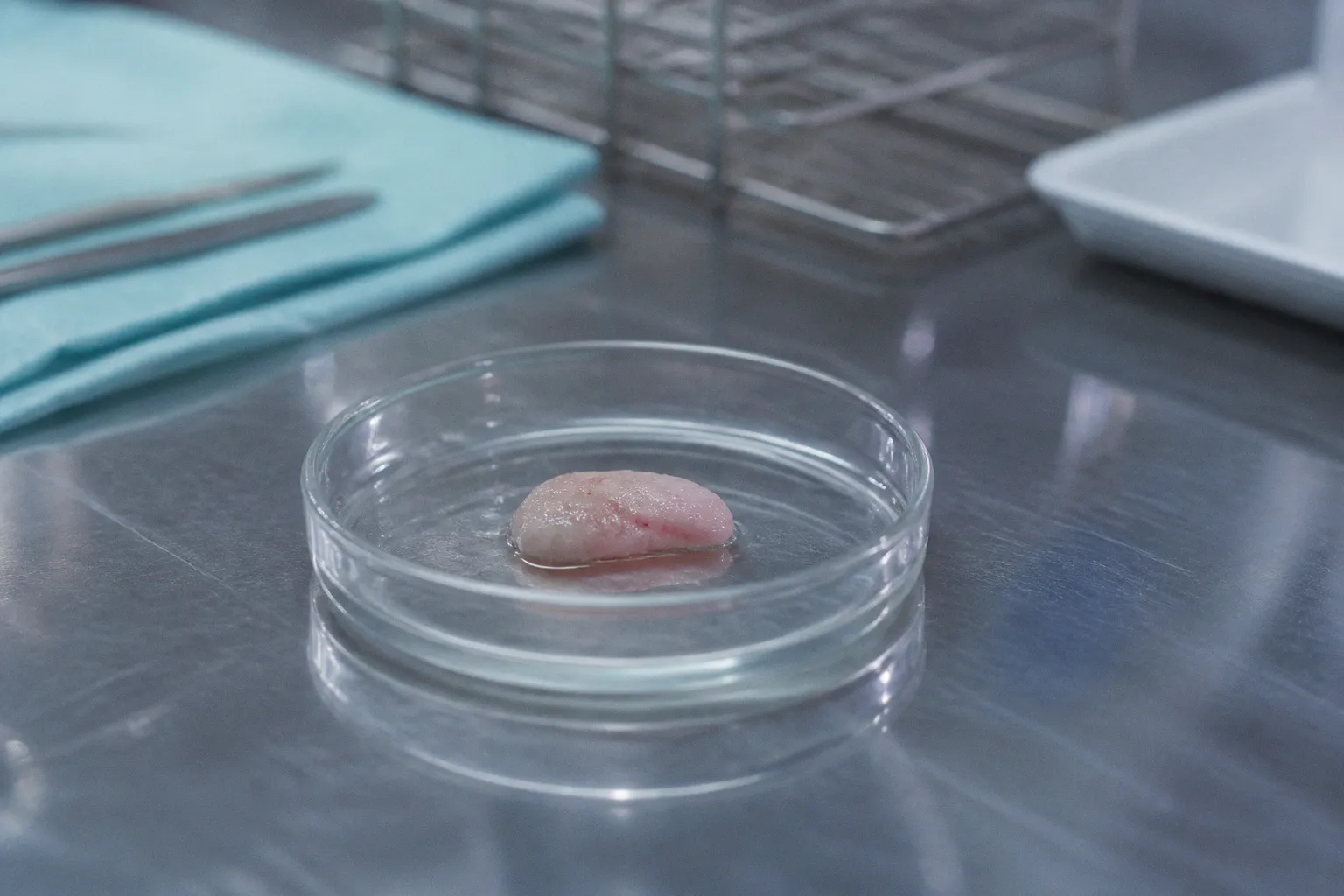 Thymus transplant vs stem cell transplant for athymia
