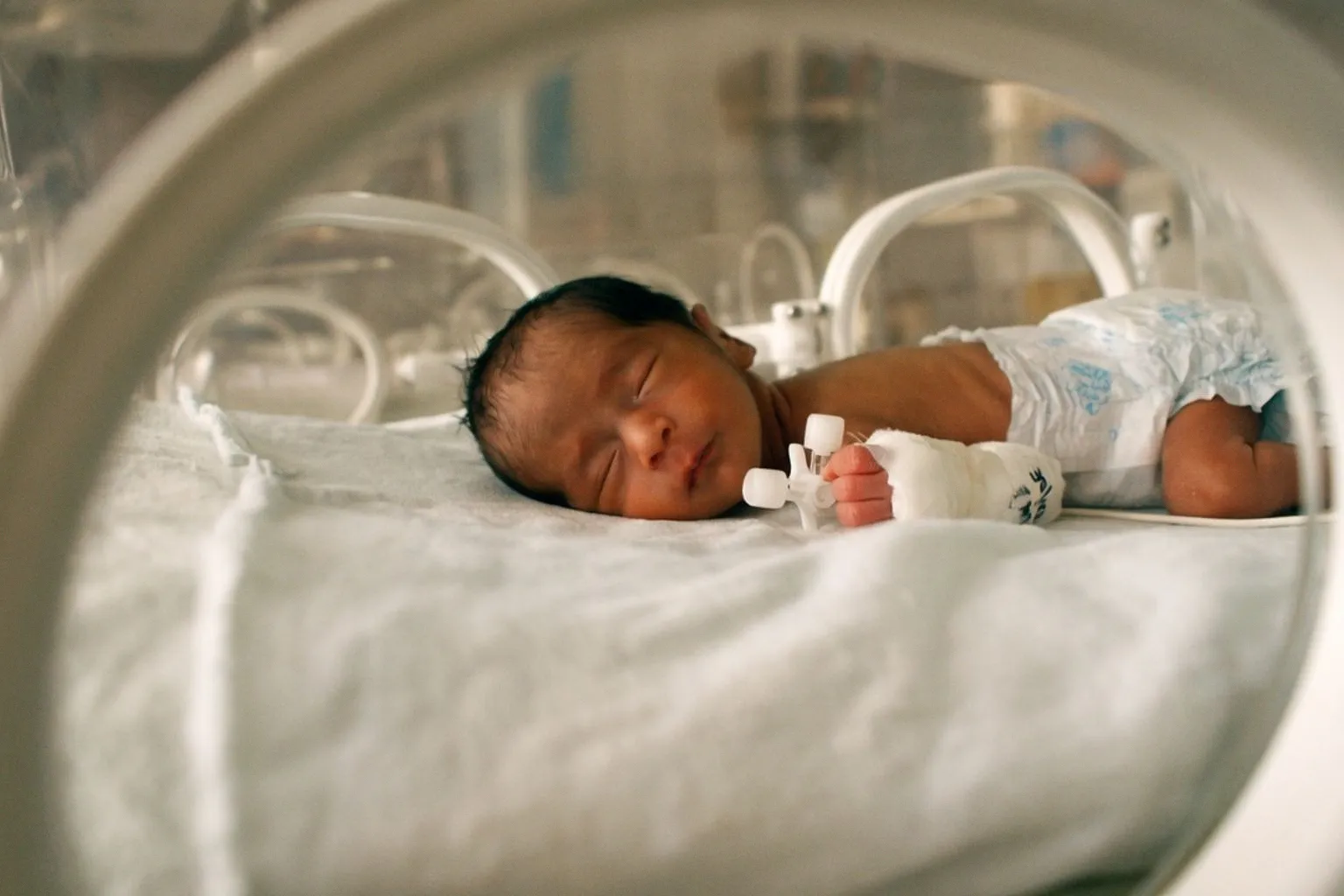 Uncovering Rare Genetic Drivers Behind Pediatric Neurodevelopmental Disorders